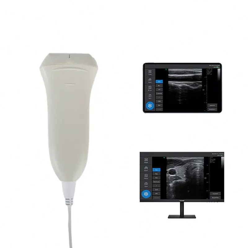 Medsinglong Handheld USB Wireless Ultrasound Scanner Smartphone/Tablet Compatible 3h Battery