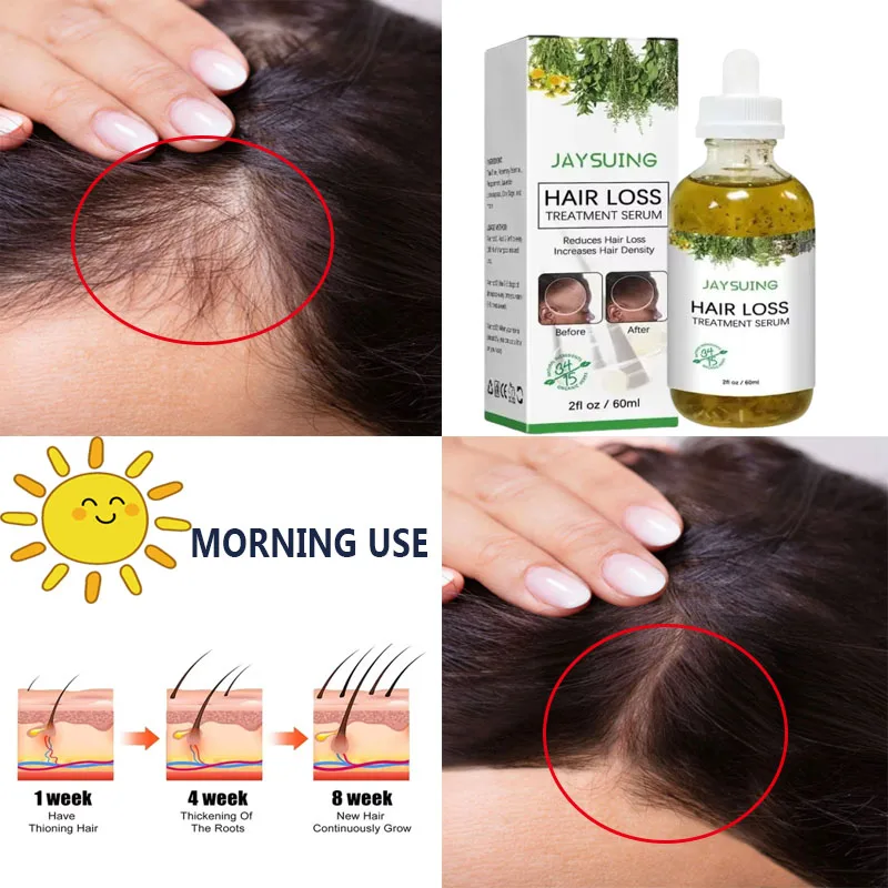 

Hair Growth&Blackening Essence Combination Prevent Hair Loss Thick hair Nourish Scalp Droplets Promote Hair Darkening Product