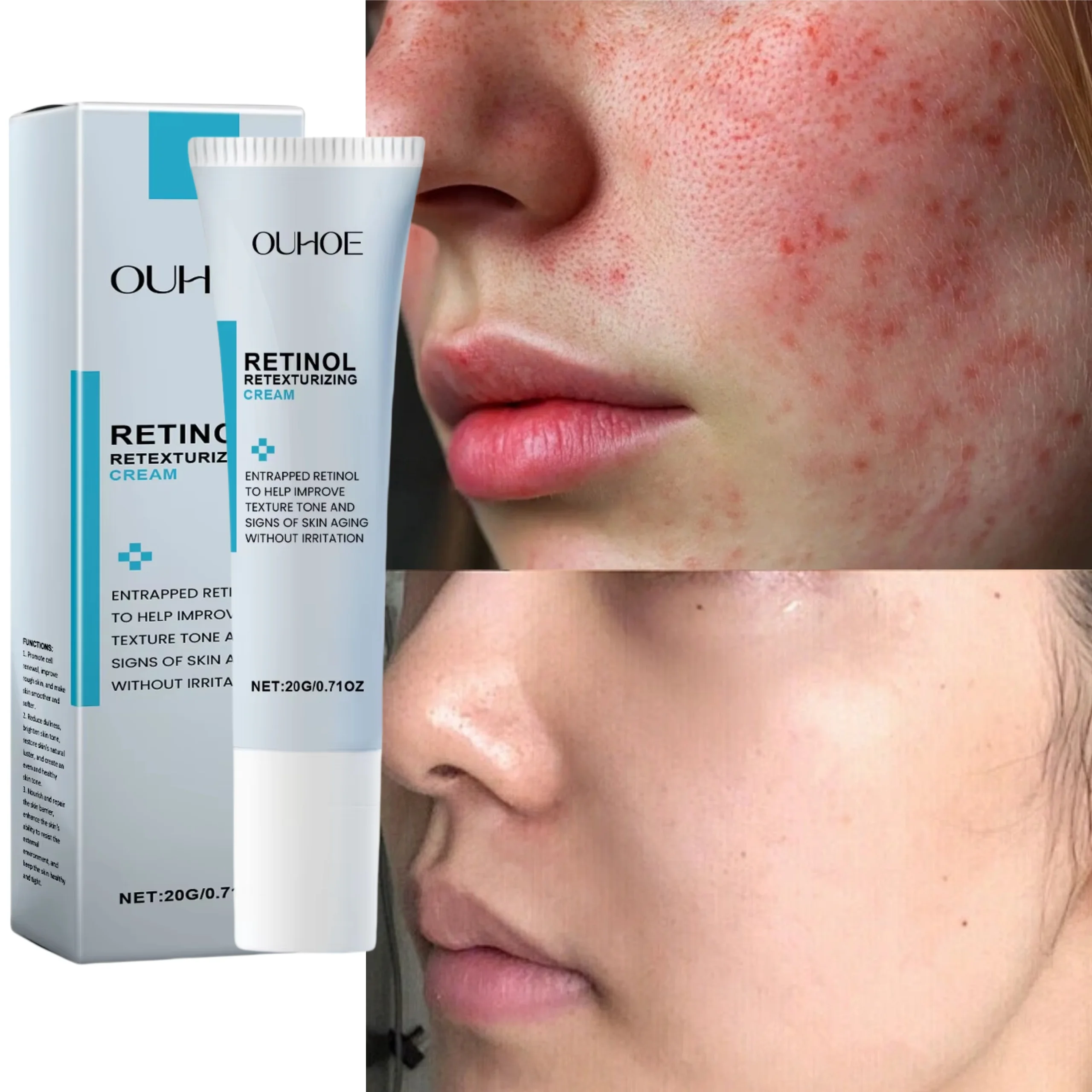 

Facial Redness Repair Cream Improve Sensitive Skin Dryness Moisturizer Hydrating Sooth Lotion Removal Rosacea Korean Cosmetics