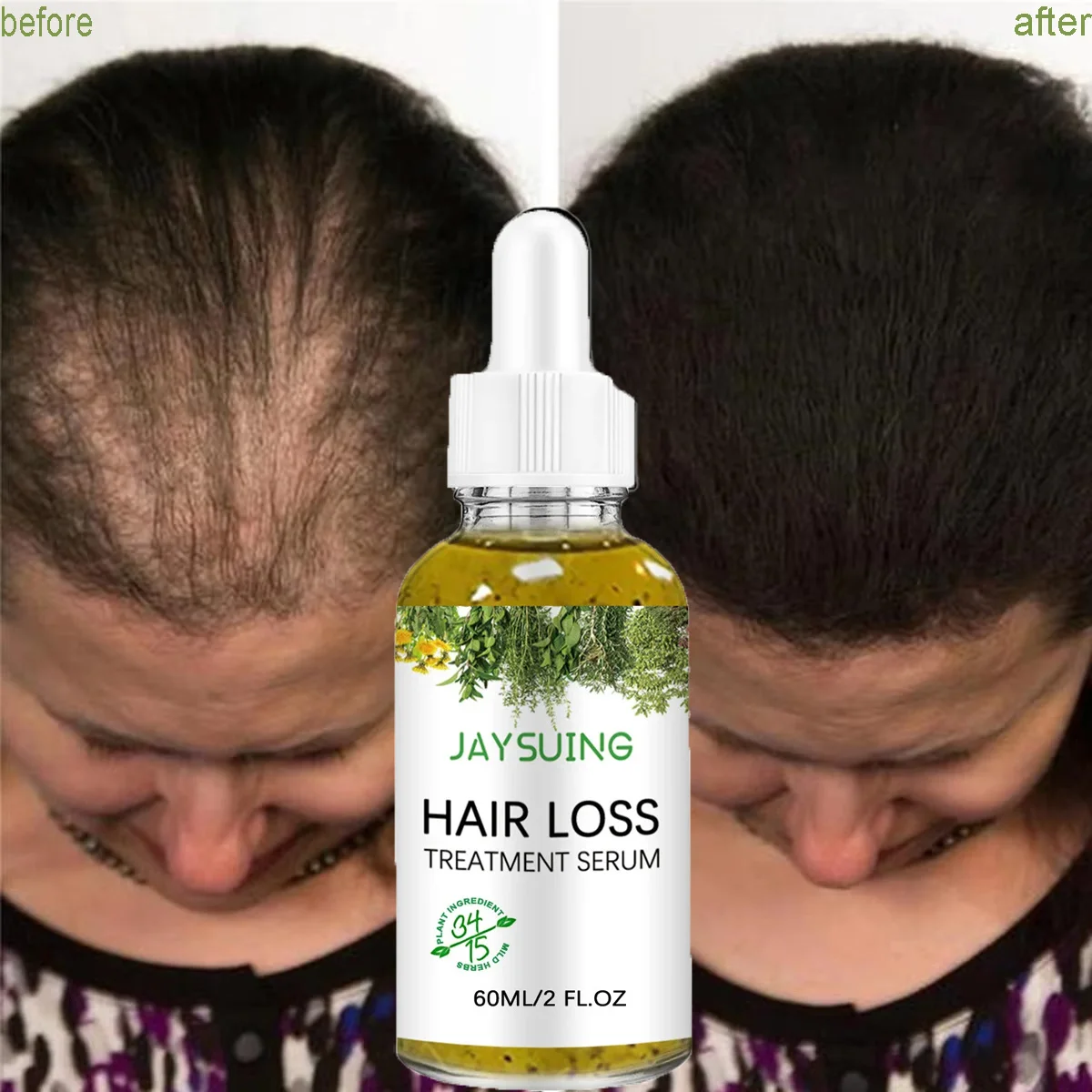 New Fast Hair Growth Serum African Crazy Regrowth Alopecia Anti Hair Loss Essential Oil Prevent Edge Bald Spot Thinnin Hair Care