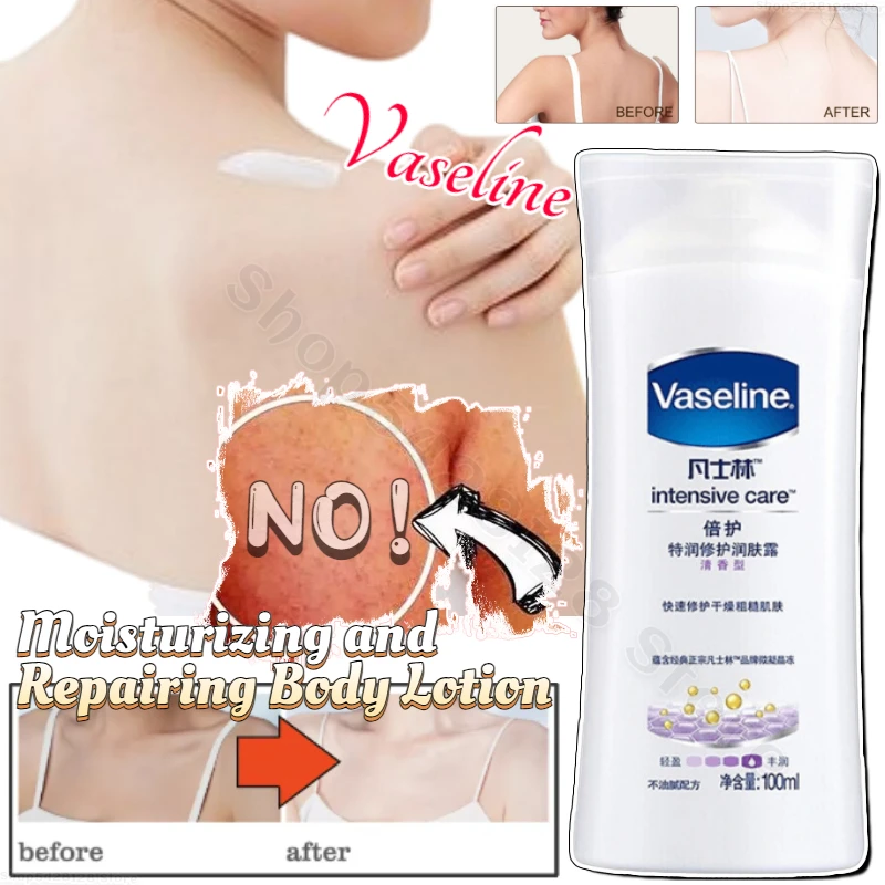 Vaseline Double Care Essence Repairing Body Lotion Portable 100ml Moisturizing Anti-drying Goose Skin Whitening Body Care Milk portable durable 16 led mouth tray set with 2 pcs dental teeth whitening gel pen smart cold blue light led tooth whitener device