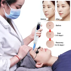 Advanced picosecond laser pointer Mole Removal Machine Warts Plasma Pen Tattoo lentiggini macchie scure rimozione del pigmento strumenti di bellezza