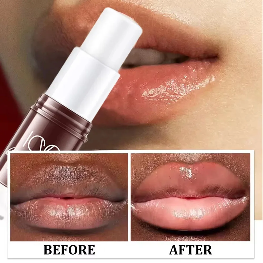 Fast Remove Dark Lip Balm Lightening Pink Lip Exfoliating Fade Lip Line Dead Skin Moisturizing Lip Beauty Care Korean Cosmetics