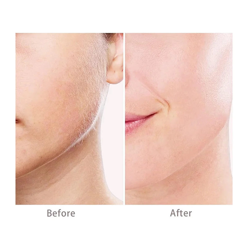 رؤوس بديلة 3 لإزالة شعر الوجه الخالية من العيوب Gen 3، شفرات بديلة بحلقة مزدوجة لجهاز الجيل 3 لا تشوبه شائبة