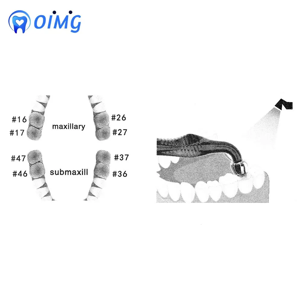 1Set Dental Orthodontic Posterior Teeth Aesthetic Printing Kit Printing Restoration Teeth Quick Built Dentistry tools Material