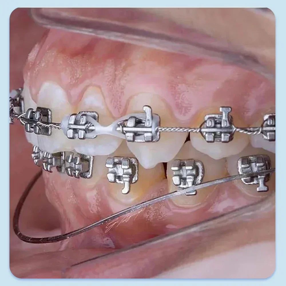 Рисунок 3 - Denspay стоматологические дуги