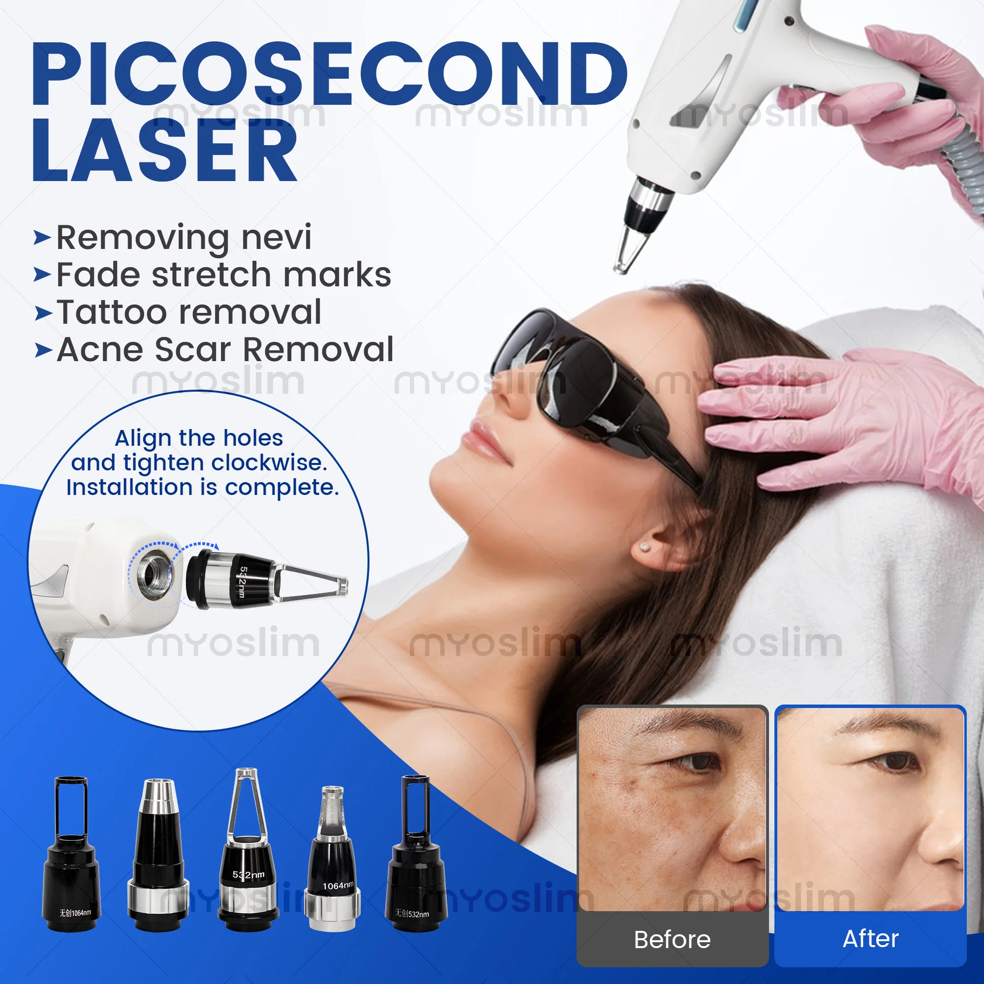 2 in 1 Diode Laser  Hair Remova Ice Painless Alexandrite Picosecond  Tattoo Removal Multi-function cooling system beauty