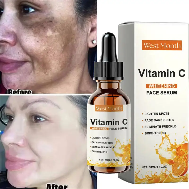 Vitamin C Whitening Serum Remove Freckles Dark Spots Face Essence Fade Melasma Melanin Brighten Repair Dull Skin Care Cosmetics