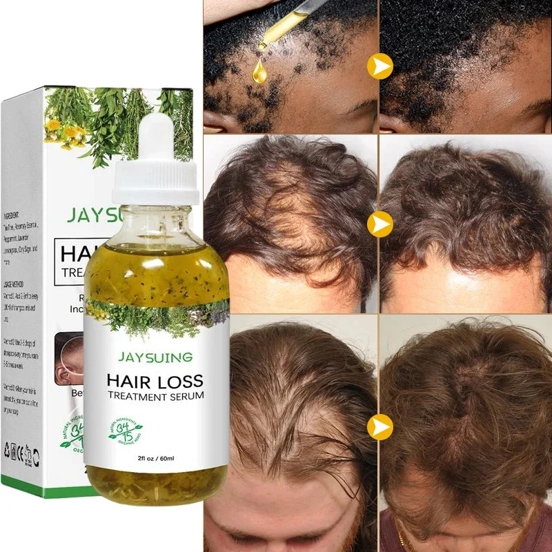 Rosemary Fast Hair Growth Serum Anti Hair Loss Nourishing Hair Scalp Treatment Essential Oil Beauty Health Care For Men Women