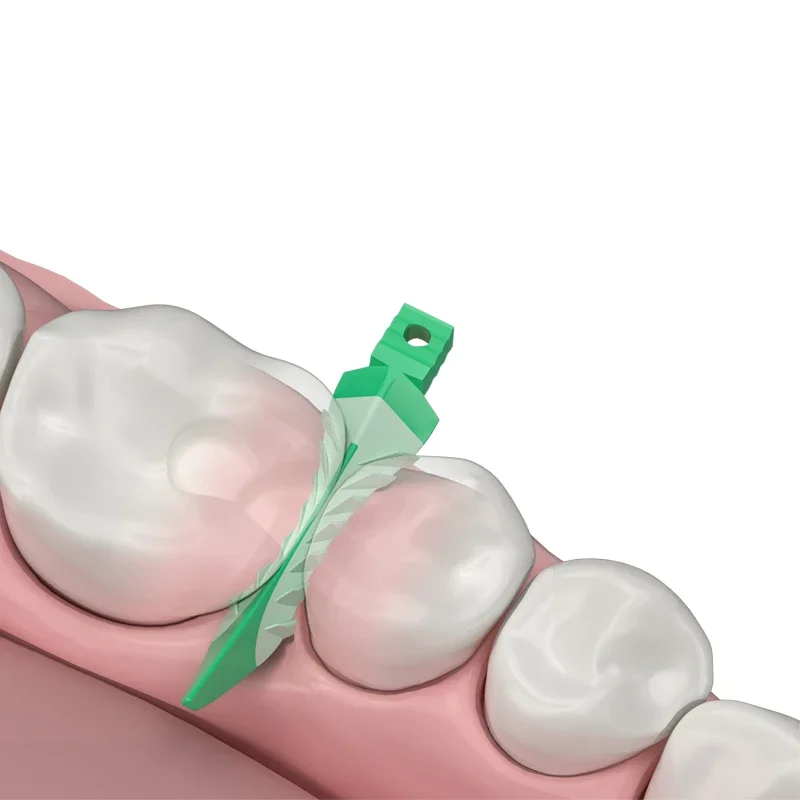 New Dental Interdental Wedges Sealing Composite Wedges Silicone Adaptive for Tooth Restoration and Cavity Preparation Tools