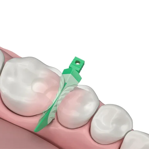 Imagen 2 del producto Nuevas cuñas interdentales dentales, cuñas compuestas de sellado, silicona adaptable para restauración dental y herramientas de preparación de cavidades