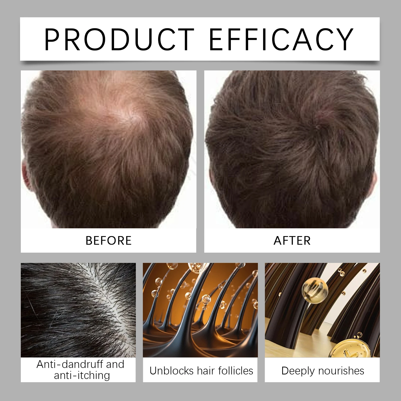 Ölkontroll-Schuppen-Shampoo für Männer, Ingwerwurzeln, Kopfhautbehandlung, reinigendes Haarshampoo, Reparatur beschädigter Haarwurzeln, Haarpflege