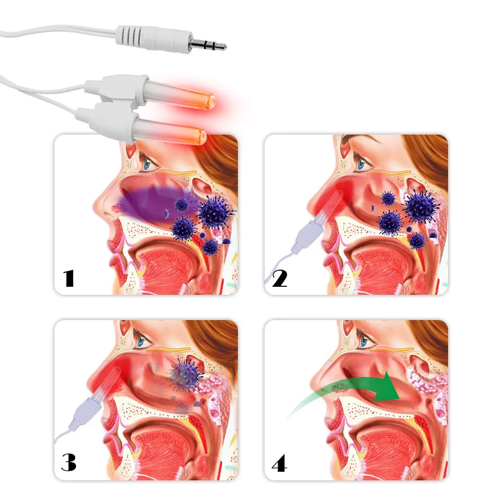 Rhinitis Sinusitis Cure Therapy BioNase Nose Treatment Nose Massage Device Cure Hay Fever Low Frequency Pulse Laser Health Care