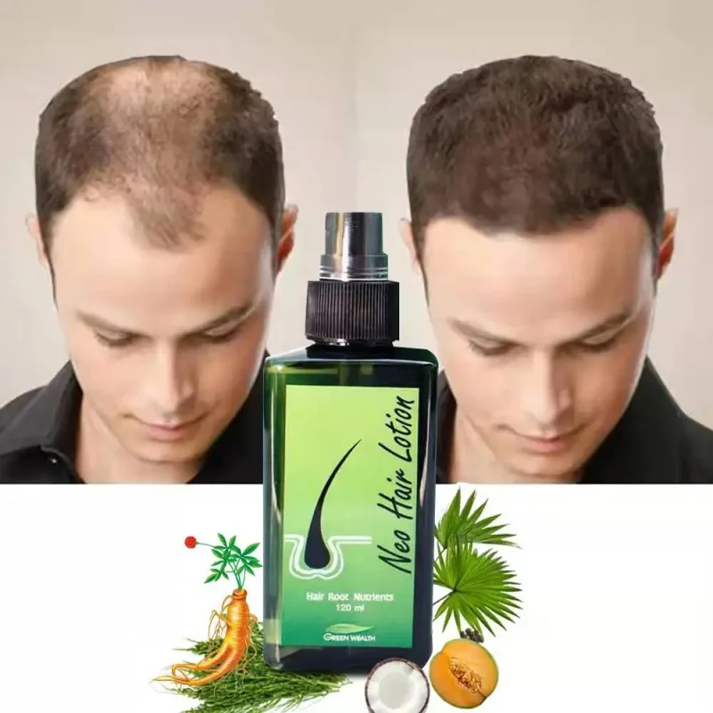 Original 120ml Thai Hair Growth Liquid Anti-Solid/growth/increase/Dense hair/Hairline Oil Control Essence