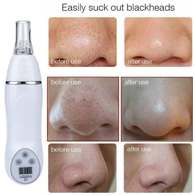 บ้านใช้ Blackhead กำจัดสิวความงามอุปกรณ์ Microdermabrasion Diamond Peeling สูญญากาศ Facial Skin Care Scar Faded ชุด