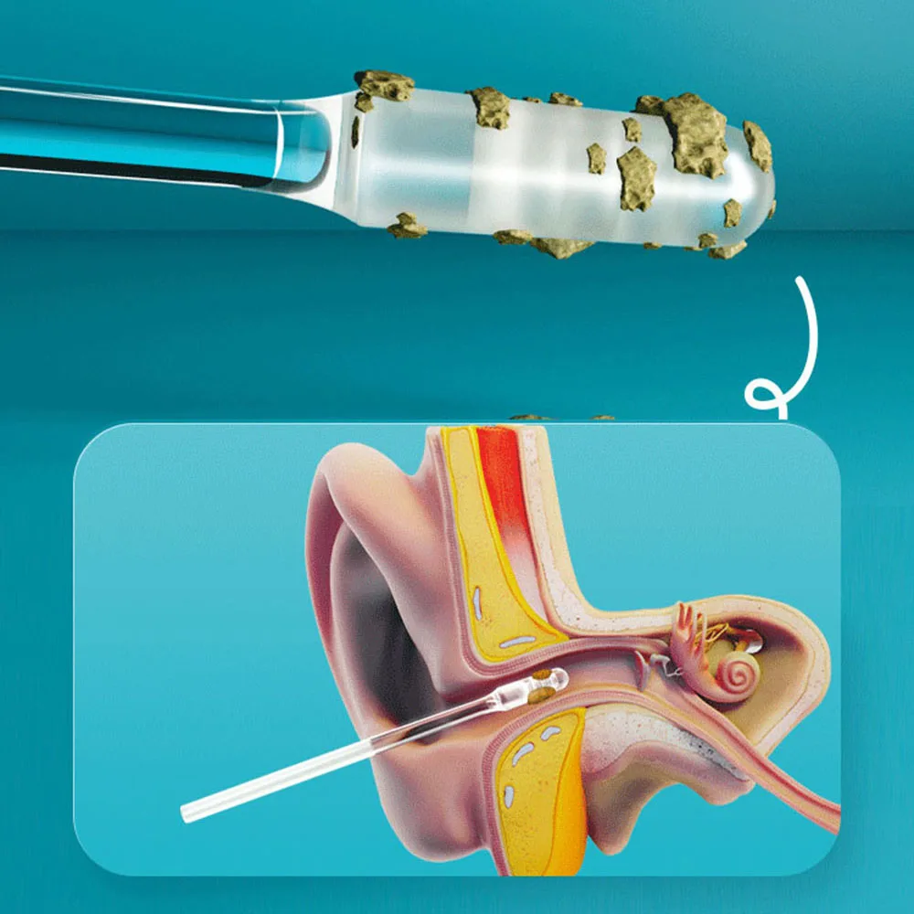 Hisopos adhesivos reutilizables para limpieza de oídos, limpiador de oídos de silicona suave, recogedor de cera, suministros diarios para el cuidado