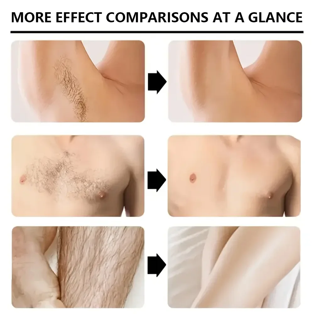 YUITIKUE Men's Hair Removal Cream 100g - Gentlemen's Choice, Full Body Usable, Mild & Quick Formula, No Black Spots image 6
