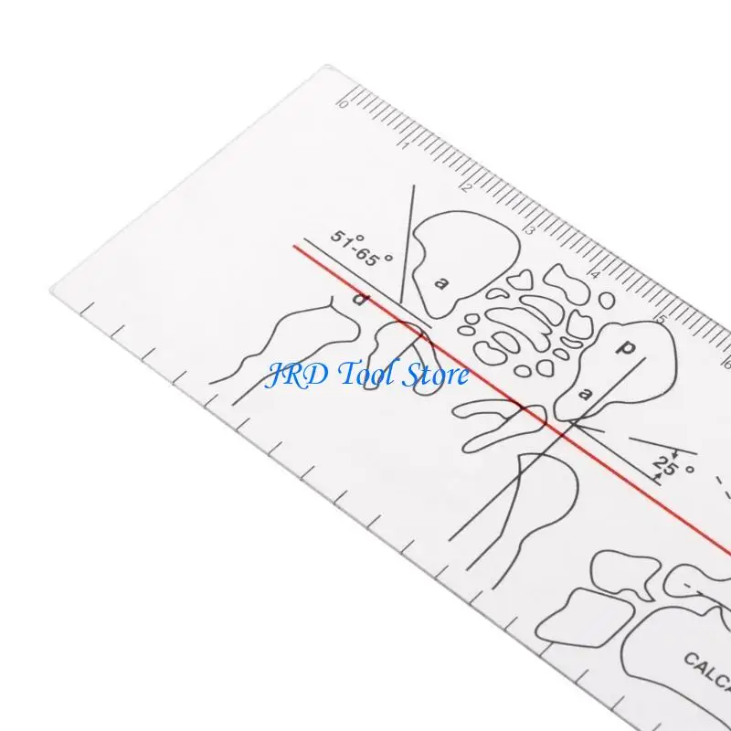A2UD Professional Tragbarer orthopädischer medizinischer Messwinkelherrscher