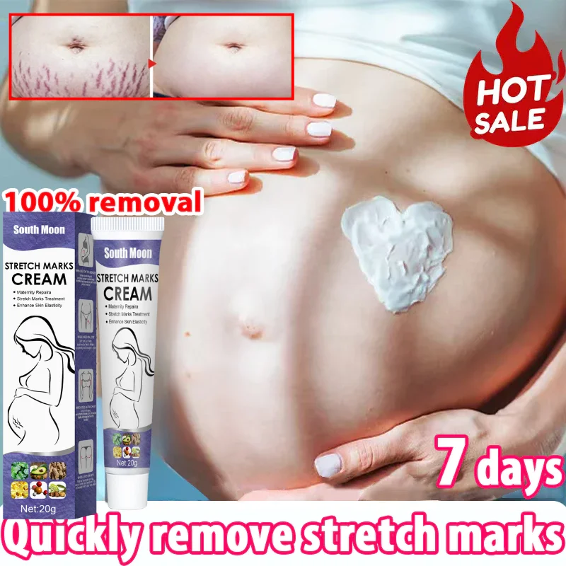 

Stretch Mark Repair Cream For Pregnant Women Postpartum Care Firm Light Lines Obesity Lines Growth Lines Repair Cream New