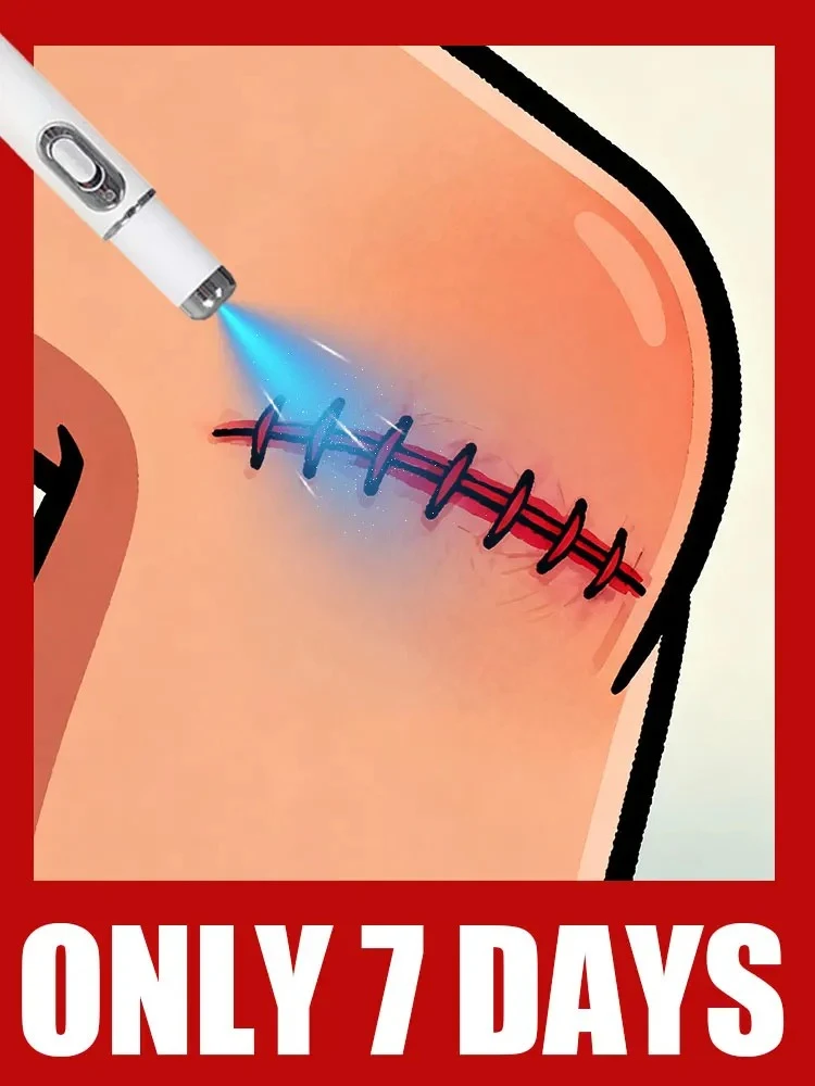 

Синий лазерный указатель. До того момента, когда исчезнет след, вы будете уверены, что это не был сон.