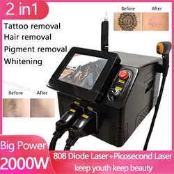 2 in 1 Picosecond Laser 808 Diode Laser Ontharing Machine en yag Tattoo Verwijdering verwijderen sproeten Carbon peeling Apparaat