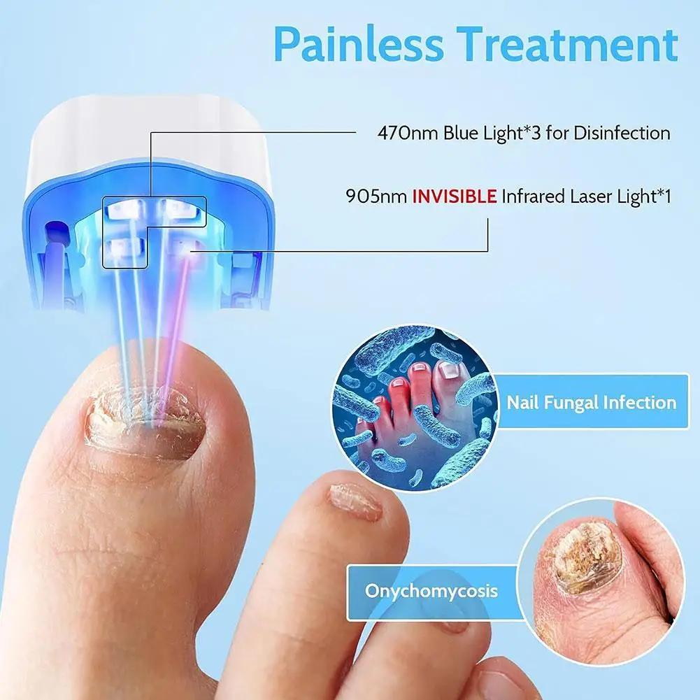 Nail Fungus Treatment LED Laser Device for Cleaning Onychomycosis USB Charge 1910nm Infrared Light 3460nm Blue Light Nail Salon