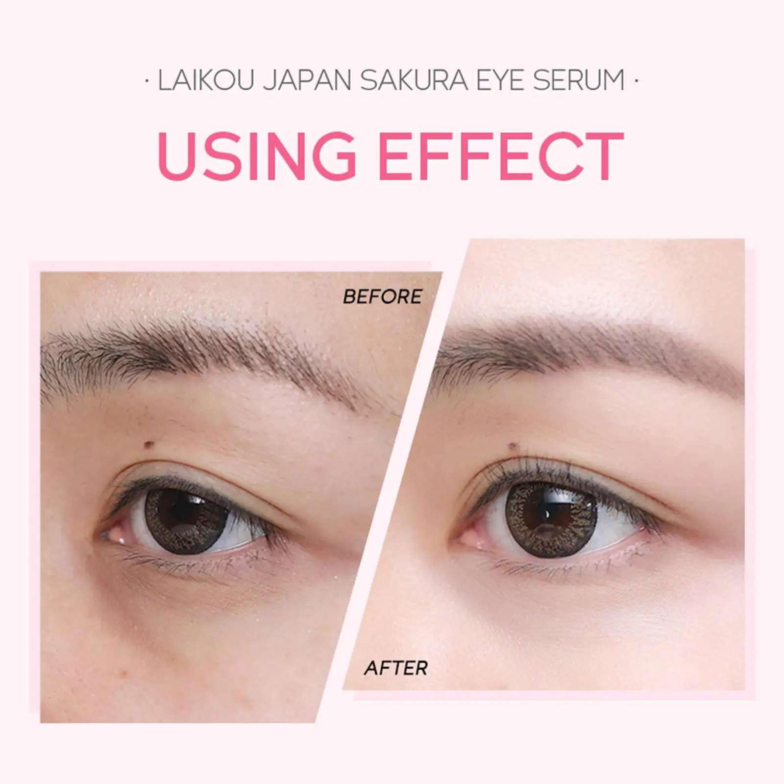 Sakura Serum Eye Roller Massage Cream Remove Puffiness Dark Circles Fine Wrinkles Moisturizing Brightening Eye Skin Care 15ml