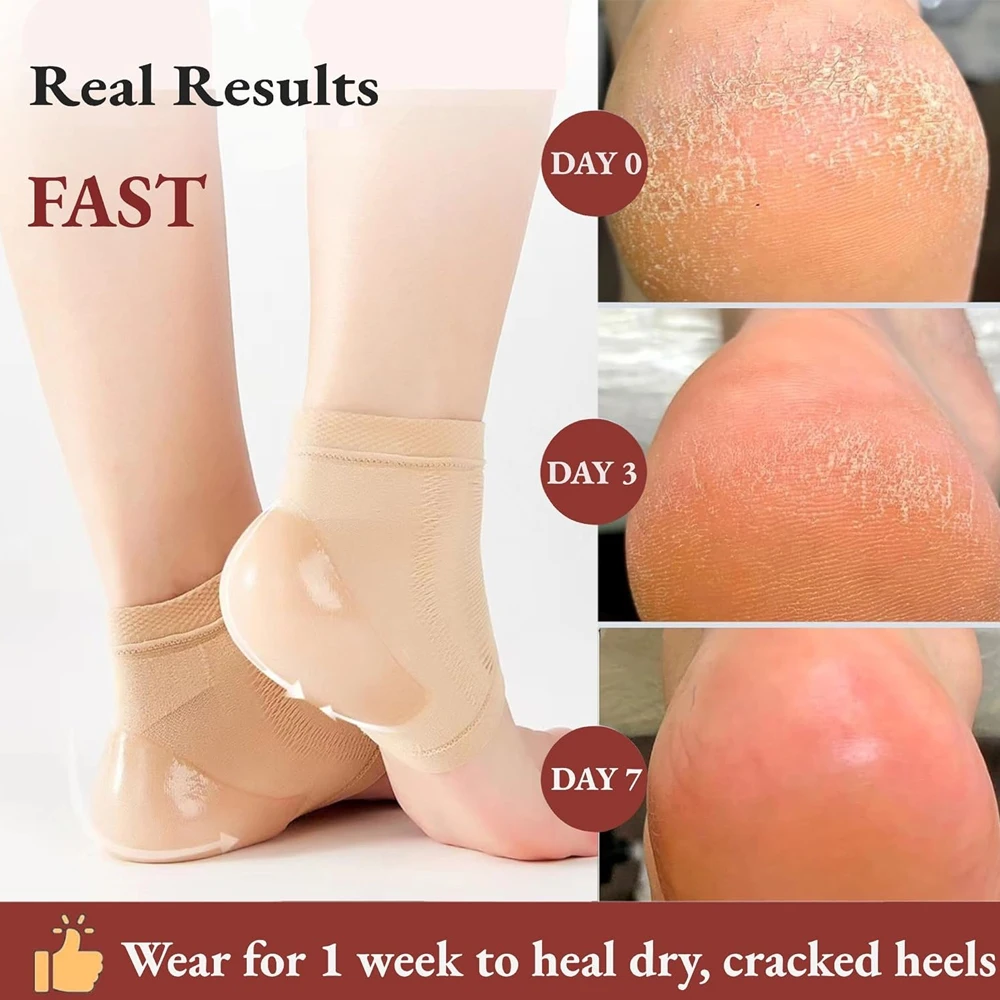 4Pcs Gel Heel Socks for Dry Cracked Heel Treatment Foot Skin Moisturizing Heel Pain Relief for Plantar Fasciitis Heel Protector