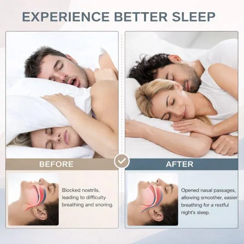 Thumbnail 3 - #9 Compare Snoring & Sleep Apnea Aids Before You Buy