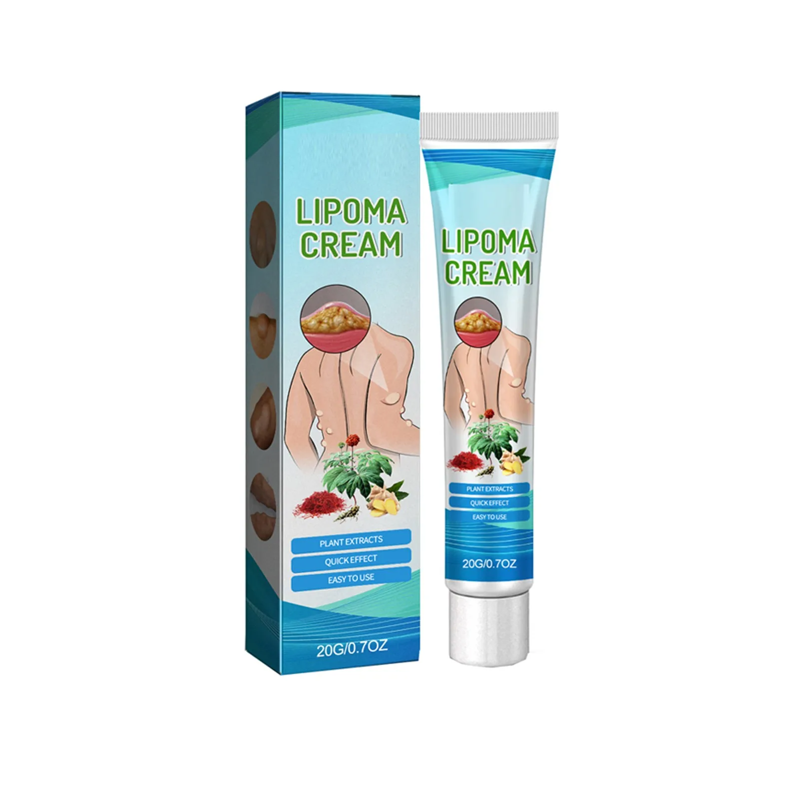 South Moon Lipoma Removal Cream Treatment Skin Swelling Lipolysis Fat Lump Cellulite Elimination Lump Nodule Smoothing Ointment