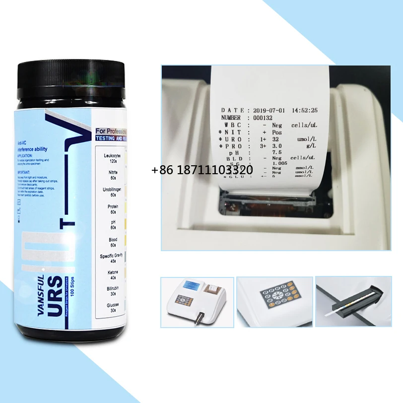 Hot Selling Product automated multi function urine analyzer strips machine Urine test equipment