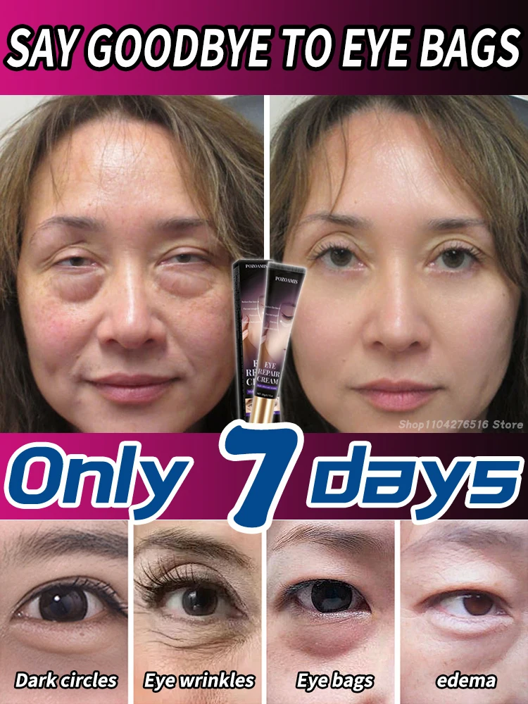 

Long-lasting moisturizing, nourishing eyes, eliminating puffiness, removing eye bags and dark circles