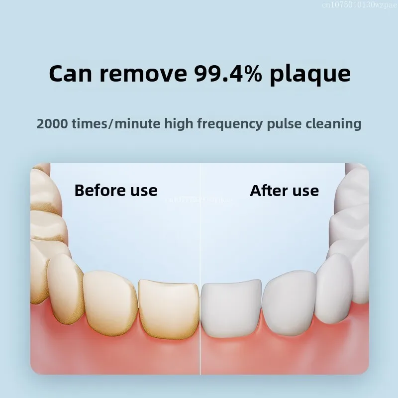 Mijia Electric Oral Irrigator F300 Portable Water Flosser IPX7 Waterproof USB Rechargeable Teeth Cleaning Oral Care Device gallery 5