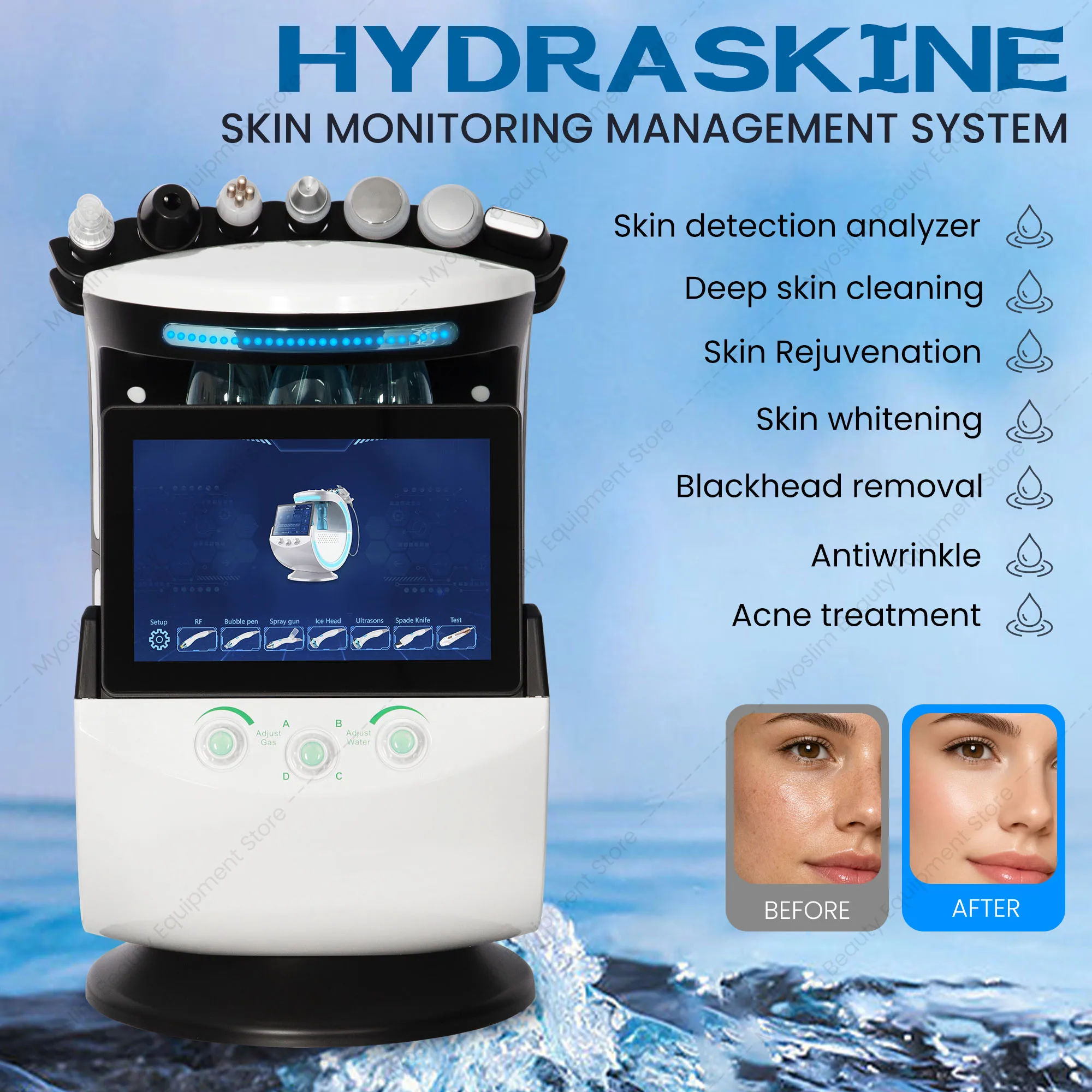 7 In 1 Smart Ice Blue Facial Management Device Hydro Dermabrasion Deep Cleaning Blackhead Suction Ultrasonic RF Ice Hammer