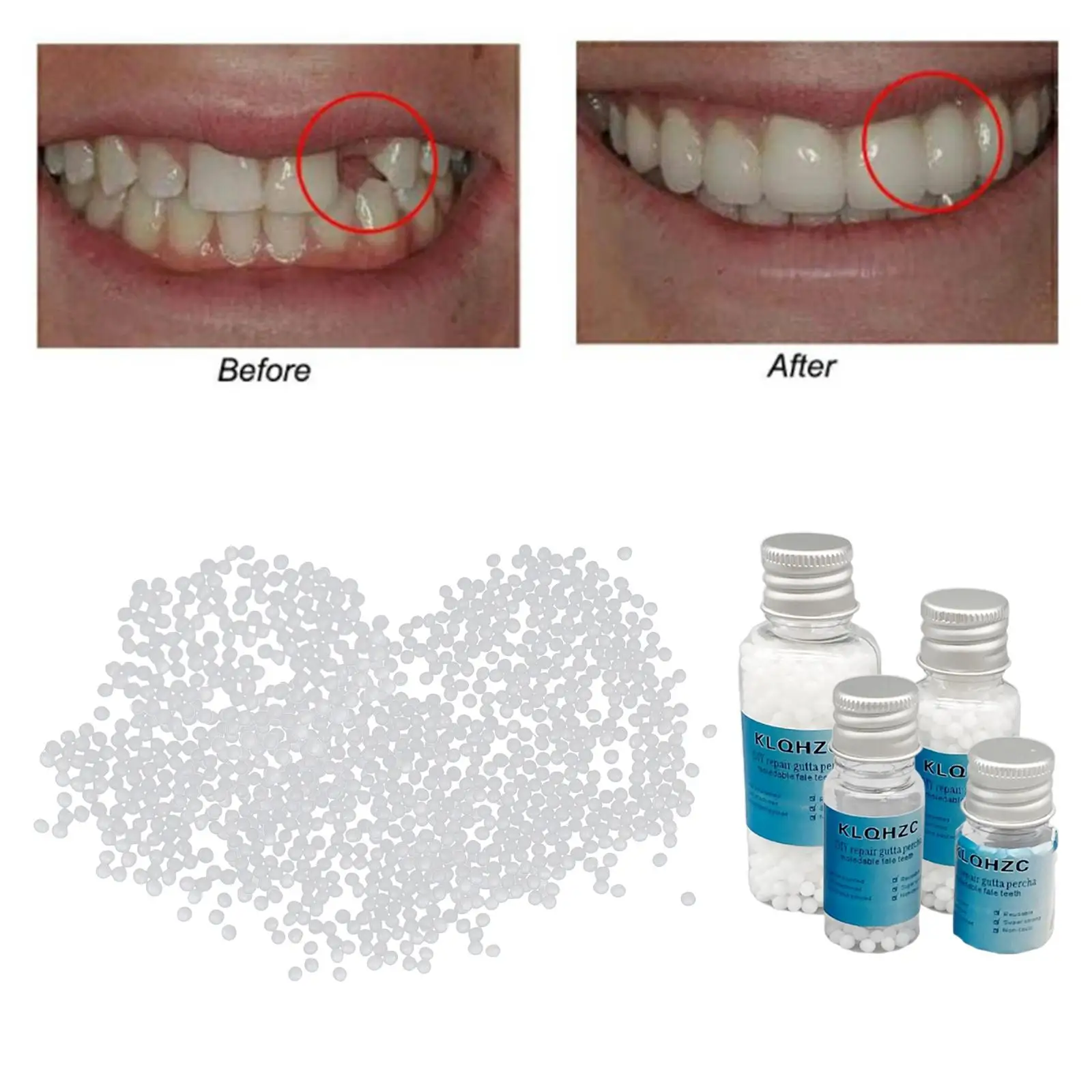 Thermal Beads Teeth Veneers Temporary Teeth Repair Kit Thermal Beads
