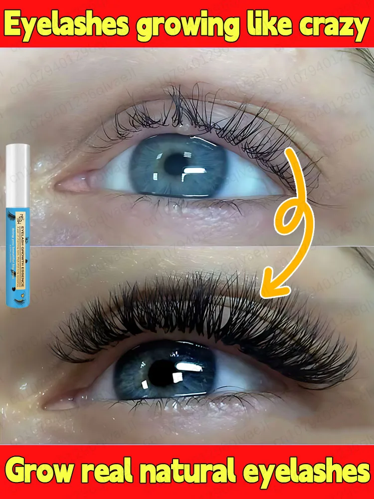 

ᴿᵃᵖⁱᵈ ᵉʸᵉˡᵃˢʰ ᵍʳᵒʷᵗʰ ˢᵉʳᵘᵐ⸴ ᵐᵃᵏᵉ ᵉʸᵉˡᵃˢʰᵉˢ ˡᵒⁿᵍᵉʳ ᵃⁿᵈ ᵗʰⁱᶜᵏᵉʳ