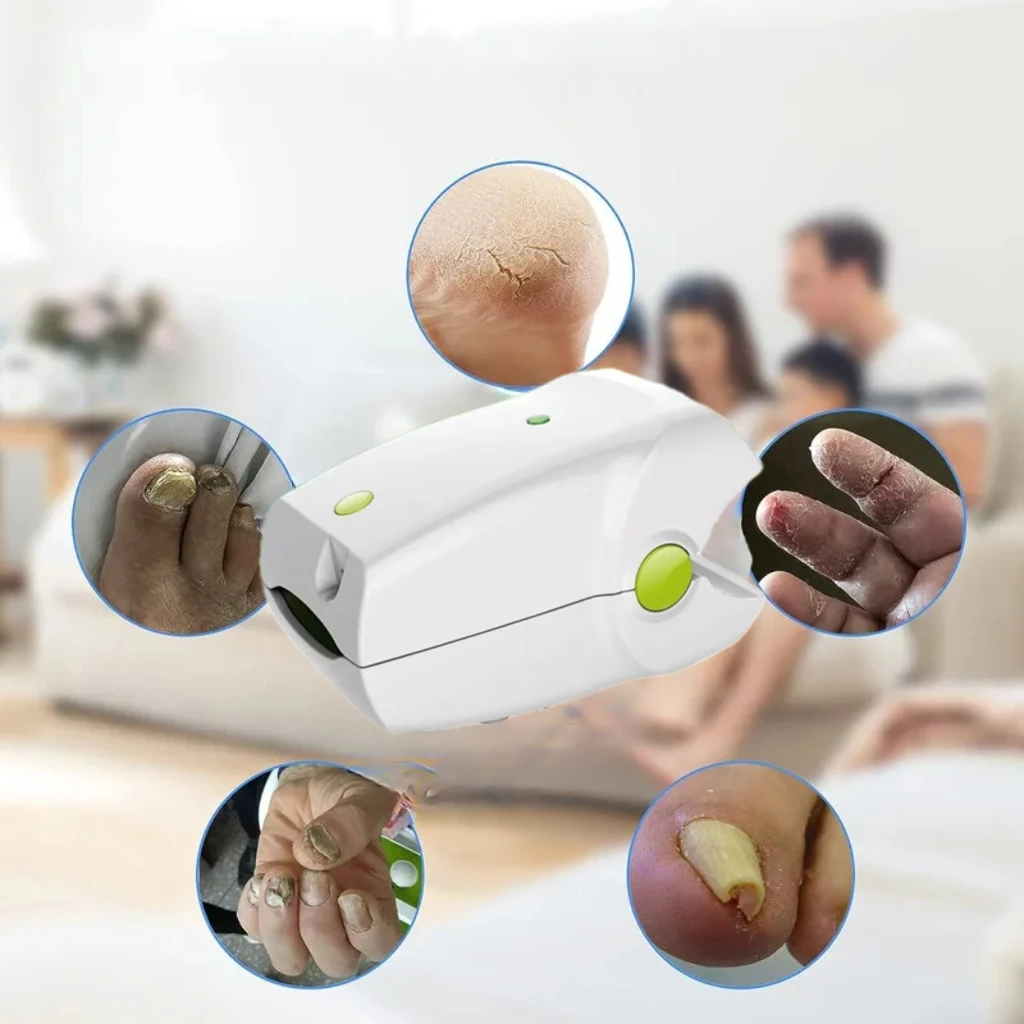 HLKGO Rechargeable Nail Repair Laser 470nm & 905nm Helps Renew Discolored Nails Gentle LLLT Technology for Home Use
