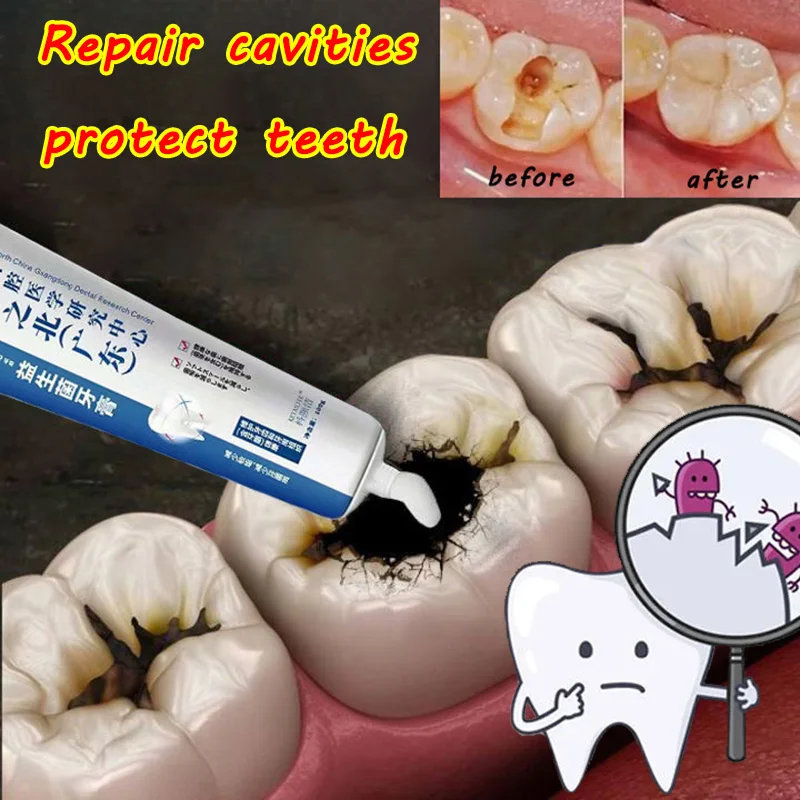 Creme Dental Clareamento De Remoção De Placa Dental, Reparação De Placa, Calcioff, Prevenção De Arranhões De Gomas Carinhadas, Cuidado Decaído