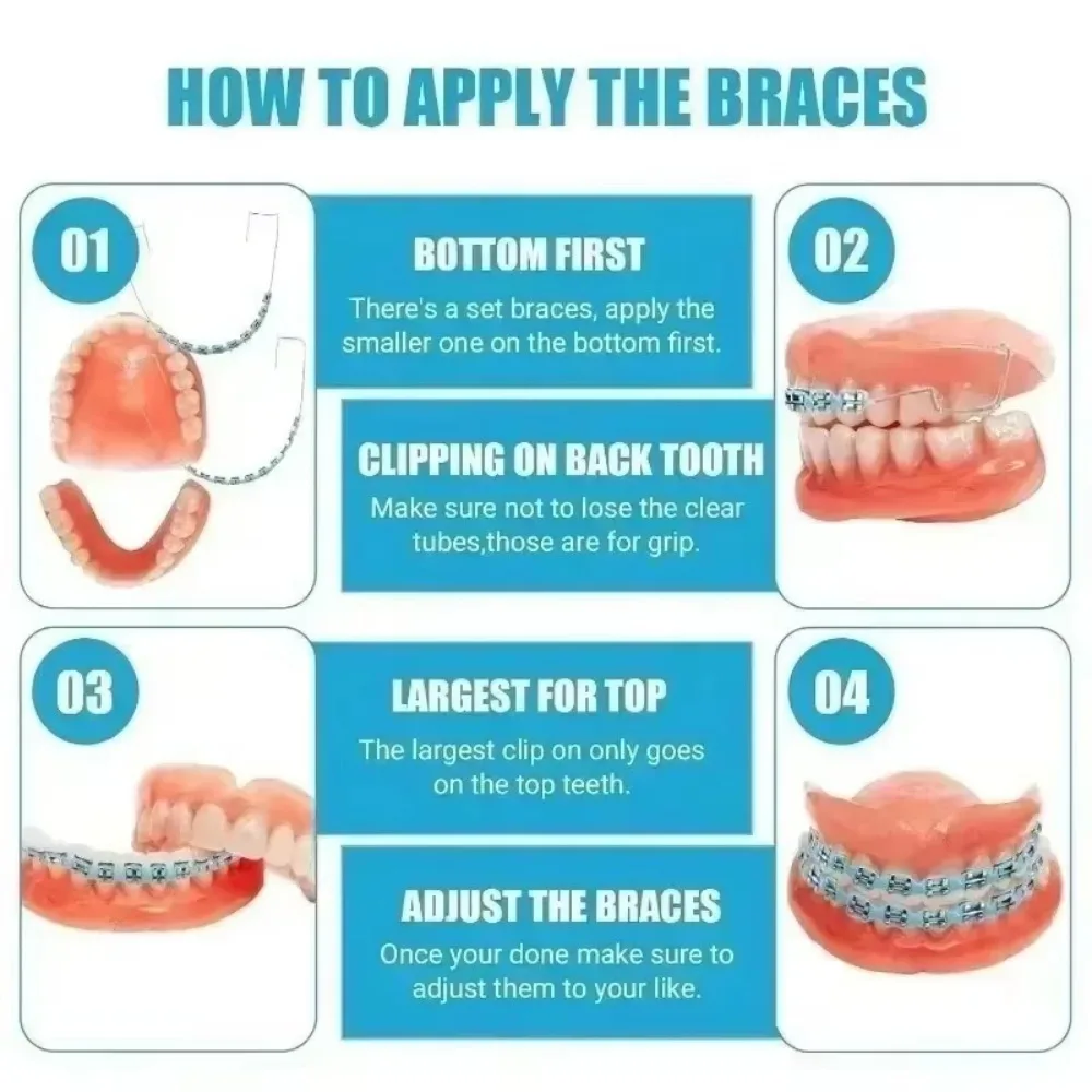 Colorful Temporary Tooth Decoration with Box, Metal Wires Orthodontic Ligature Ties & Fake Braces Brackets Quality 1 Pair