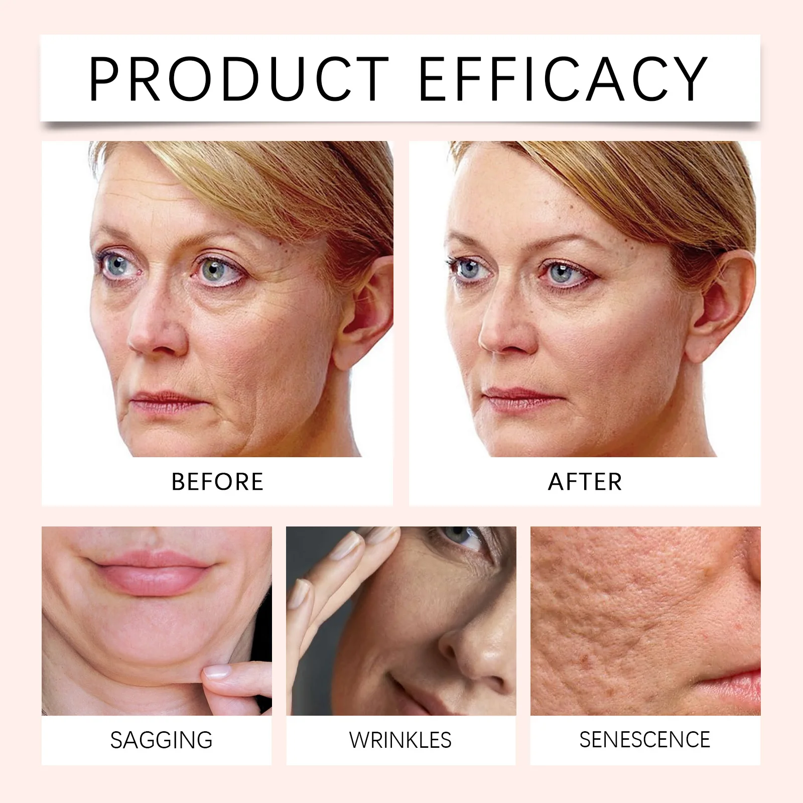 كينتيللا كلاي ستيك قناع المسام تقليل الترطيب السريع مهدئا الوجه اشراق قناع الوجه العناية بالبشرة 27 جرام #5