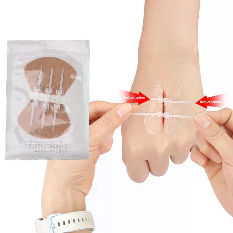 1/2/3 buckle Zip Suture Reducer Band Aid Zipper Band-aid Painless Wound Closure Device Suture-free Wound Dressing Patches