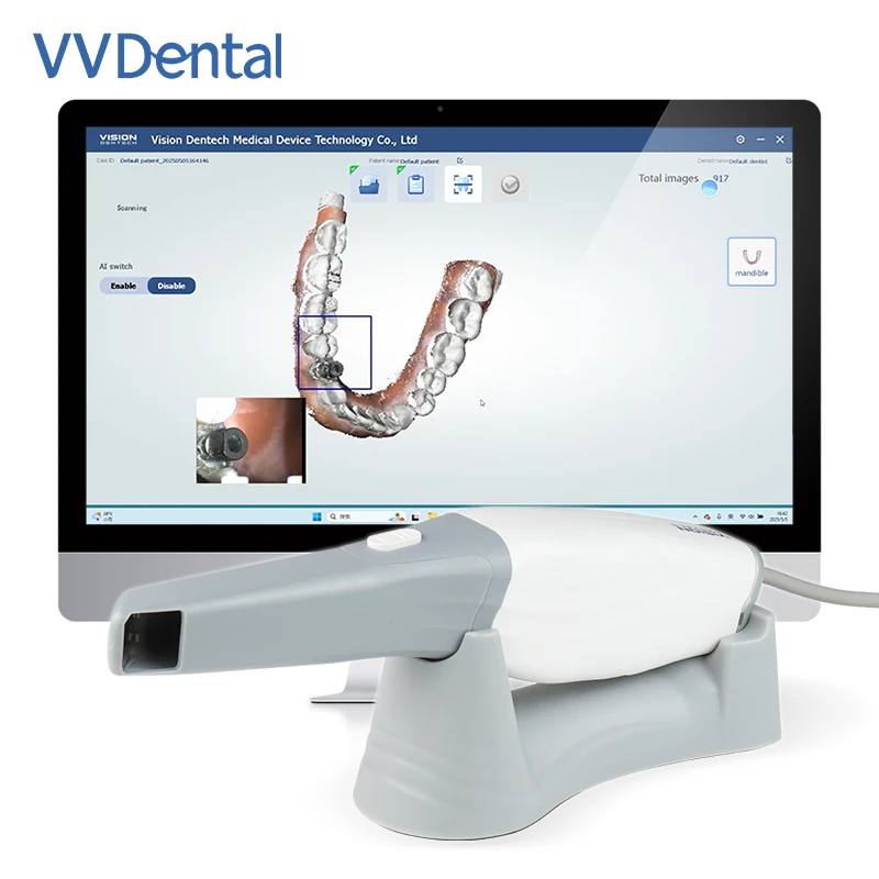 VVDental Dental 3D Intraoral Scanner Real Color USB Pro Dental Digital Impression System for Implant Orthodontics Restoration