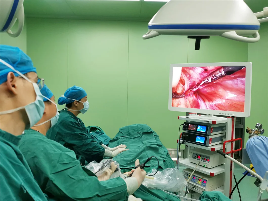 Factory Price Medical Euprun Flexible Video Gastroscope For Human And Veterinary