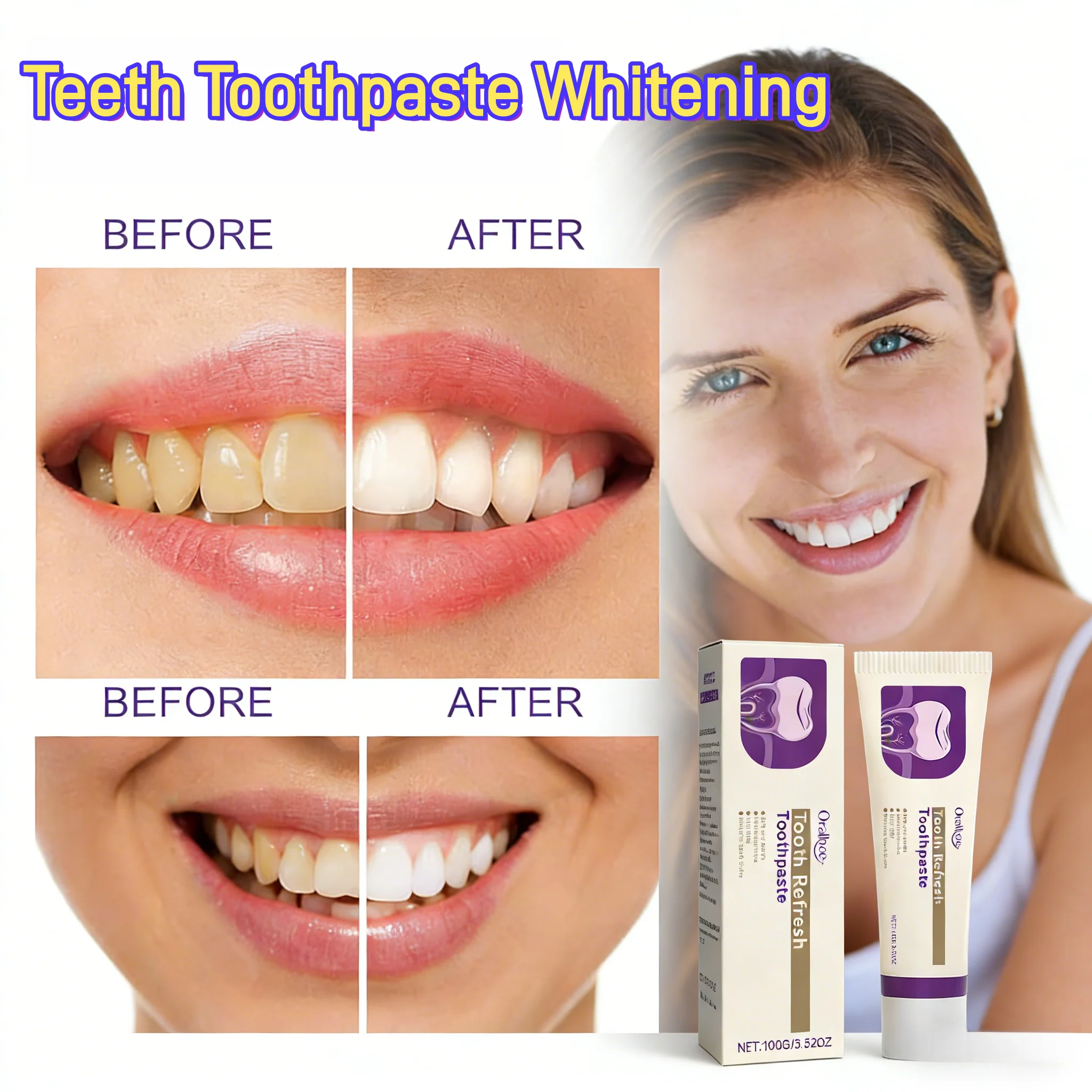 Teeth Whitening Paste - Dentifrice blanchissant pour les dents, rafraîchit