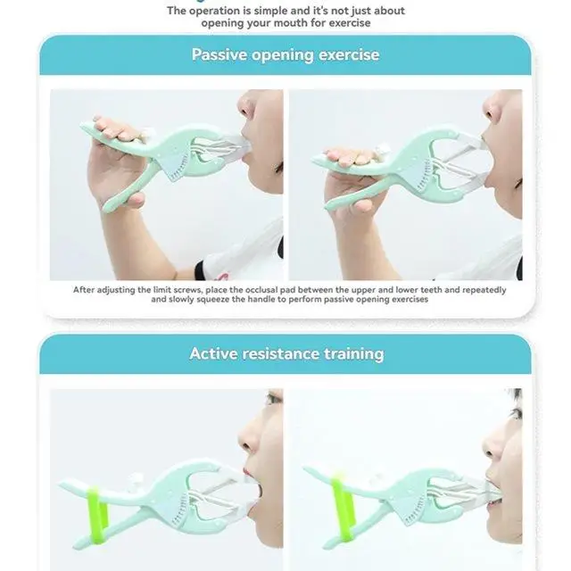 【A43I】 Open Mouth Expander Open Mouth Trainer Oral Mouth Rehabilitation Exercise Expansion Lip Muscle Trainer image 5