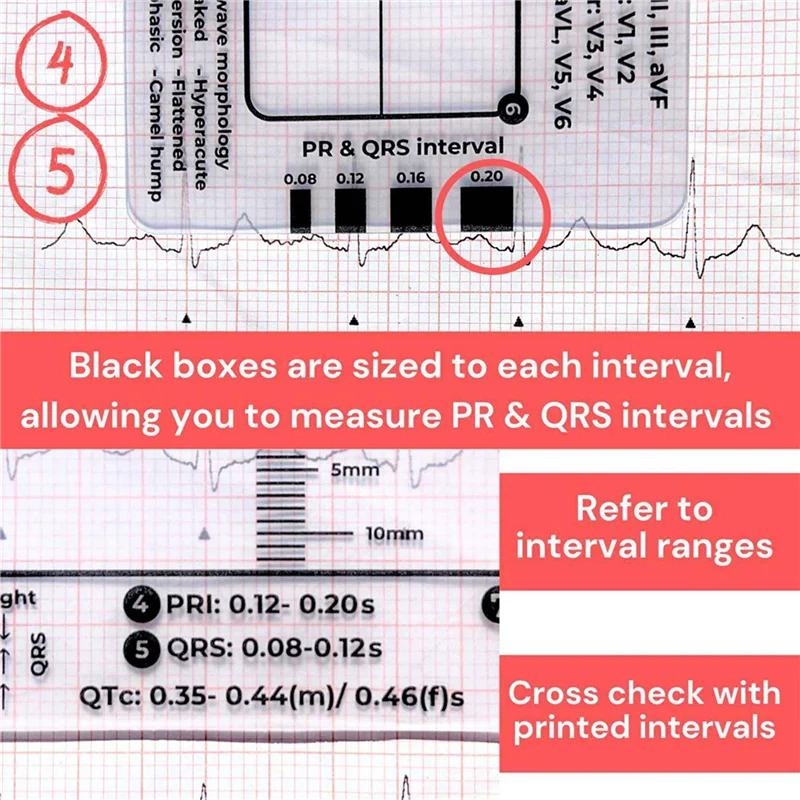 

BT-5X ECG 7-ступенчатая линейка, ЭКГ 7-ступенчатая линейка для Интерпретации ЭКГ/ЭКГ, инструмент для быстрого и быстрого анализа и измерения картрика