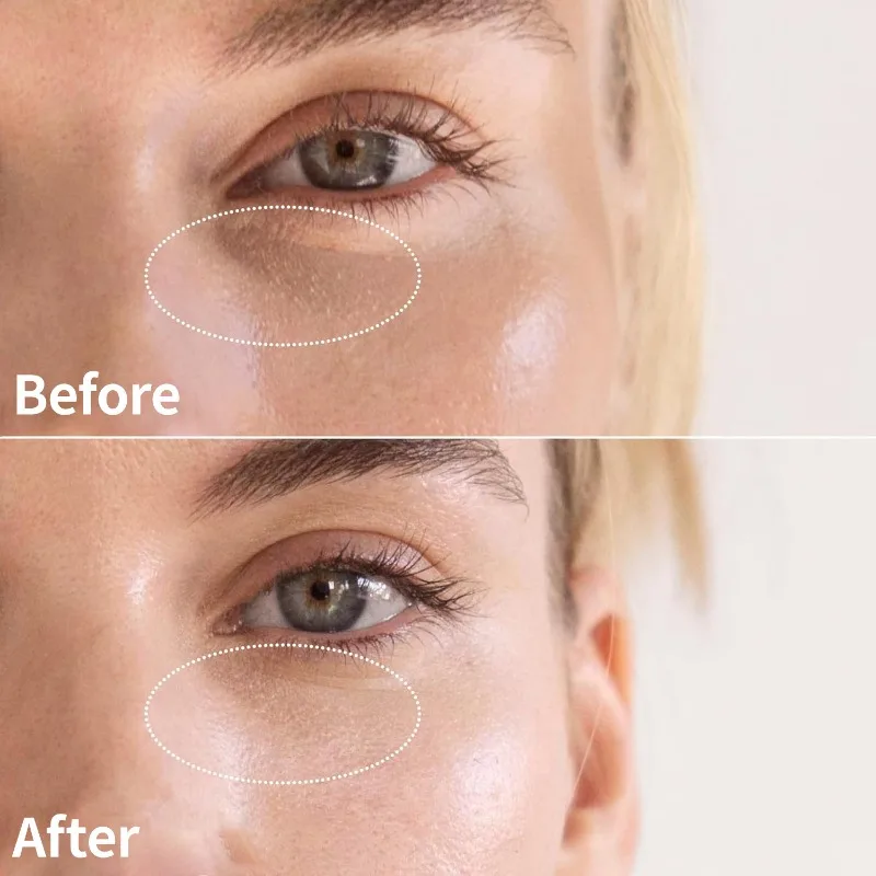 Creme para os olhos em bastão, clareador de olheiras, desbota fina, anti-rugas, hidratante, aperta, reparação e suavizante, produto de cuidados com a pele