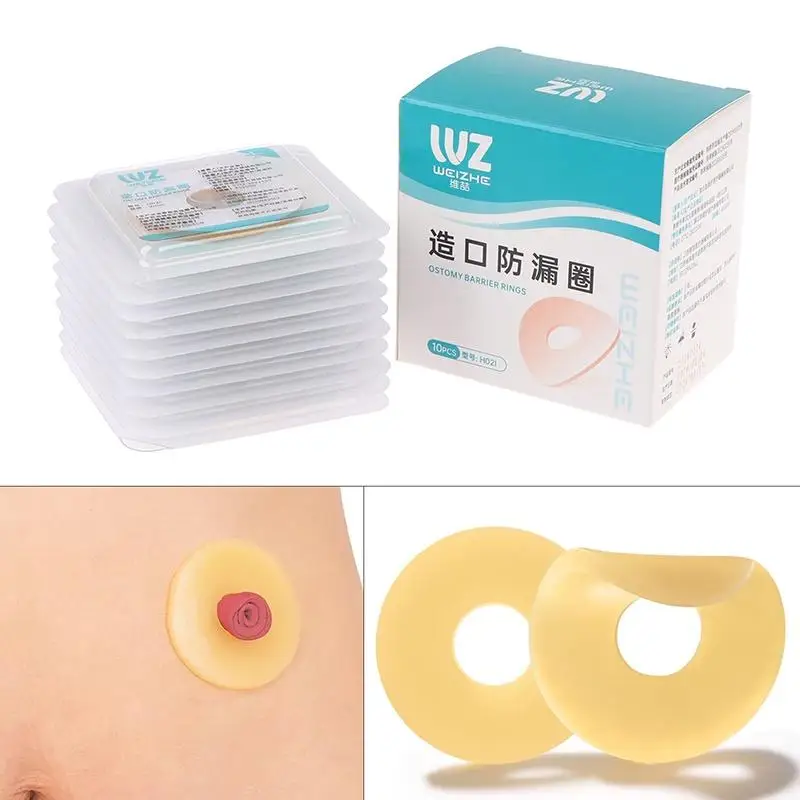 10Pcs Baseplates Stoma Care Products To Protect Skin Anti-Leakage Ring For Colostomy Bag Ostomy Paste Ring
