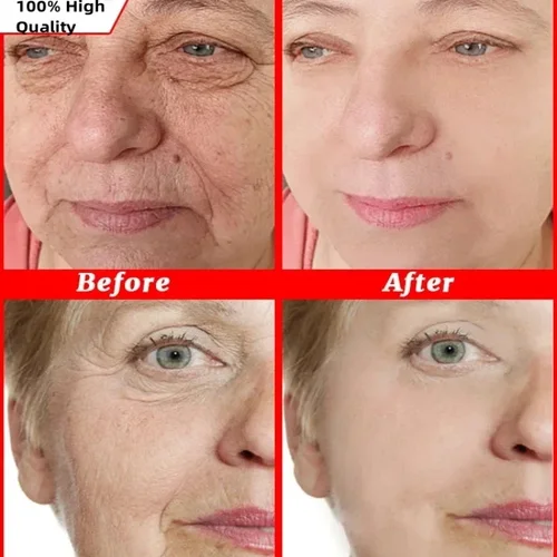 Imagen 2 del producto Eliminador instantáneo de arrugas, crema facial antienvejecimiento, reafirmante, se desvanece, líneas finas, blanqueamiento, hidratante, ilumina, reafirma el cuidado de la piel