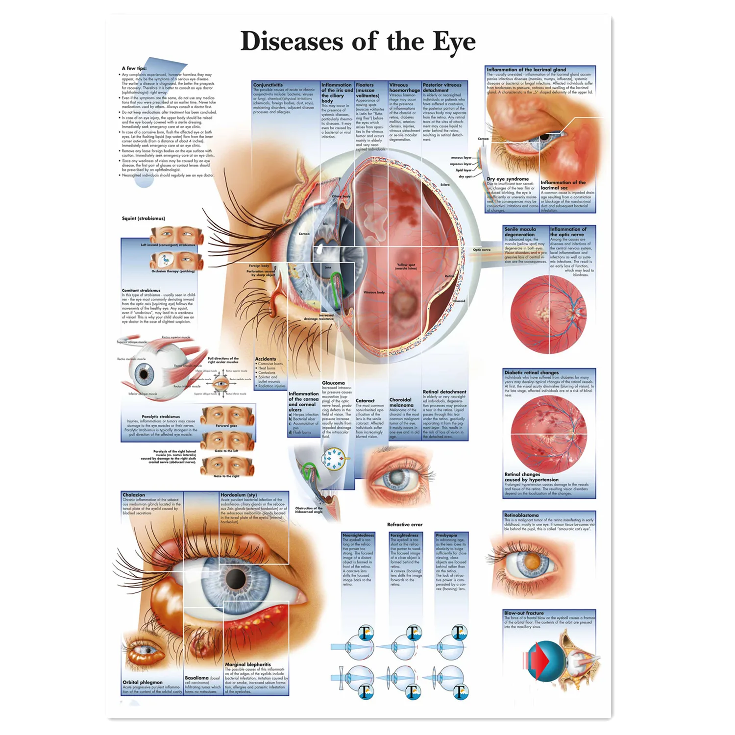 Diseases of The Eye Poster Prints Wall Chart Human Anatomy Medical Artwork Wall Art Canvas Painting Hospital Clinic Home Decor 0